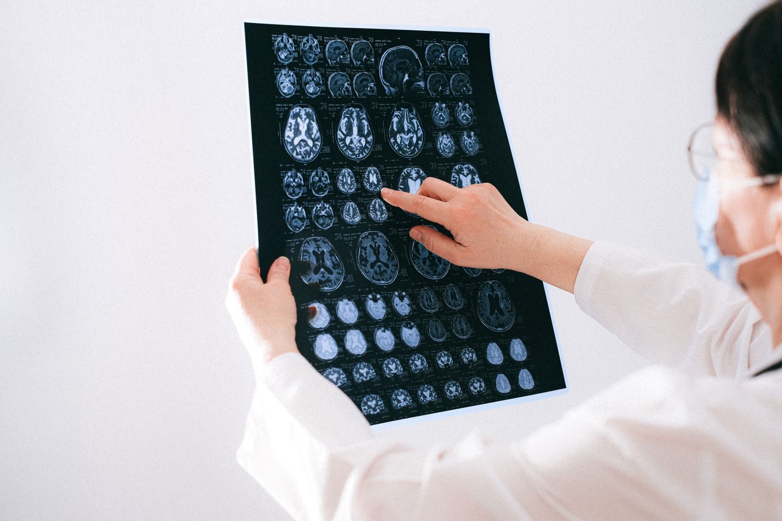 analayse cerveau sommeil